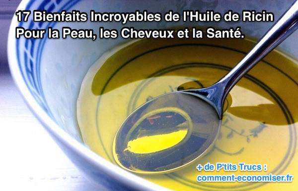 Bielita la crème des taches de rousseur