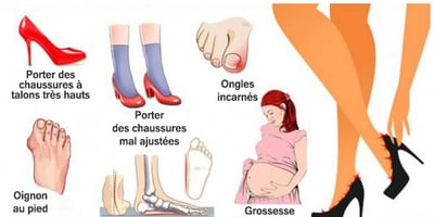 10 Causes des Douleurs aux Pieds et Comment y Remédier 10 Causes des Douleurs aux Pieds et Comment y Remédier