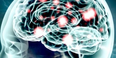 10 Façons D’augmenter la Dopamine dans votre Cerveau 10 Façons D’augmenter la Dopamine dans votre Cerveau