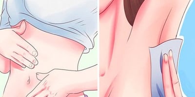 10 Signes que Votre Foie ne Fonctionne pas Correctement et que les Toxines S’accumulent dans Vos Tissus Adipeux ! 10 Signes que Votre Foie ne Fonctionne pas Correctement et que les Toxines S’accumulent dans Vos Tissus Adipeux !