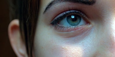 Conseils pour Lutter Contre les Points Noirs et les Pores Dilatés au Naturel