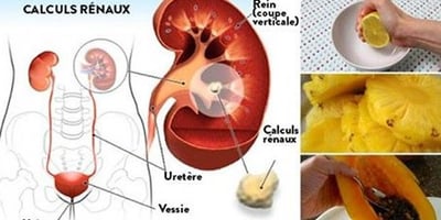 13 Fruits qui vous Guérissent