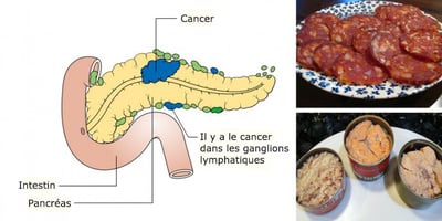 14 Aliments Cancérigènes que Vous Ne Devriez Plus Jamais Mettre Dans Votre Bouche 14 Aliments Cancérigènes que Vous Ne Devriez Plus Jamais Mettre Dans Votre Bouche