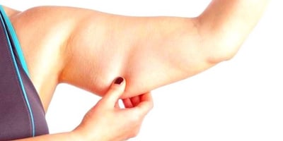 14 Astuces pour Perdre la Graisse sous les Bras 14 Astuces pour Perdre la Graisse sous les Bras
