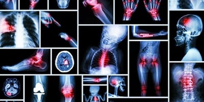 20 Sources de Douleur qui sont Directement Liées à des États Émotionnels Spécifiques