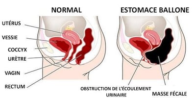 3 Conseils pour Dire Adieu aux Ballonnements et Retrouver un Ventre Plat ! 3 Conseils pour Dire Adieu aux Ballonnements et Retrouver un Ventre Plat !
