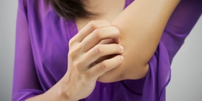 3 Étapes Simples pour Soulager L'eczéma