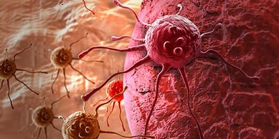 4 Aliments qui Détruisent les Cellules Cancéreuses