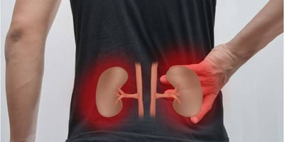 4 Signes Fréquemment Ignorés qui Pourraient Indiquer une Insuffisance Rénale