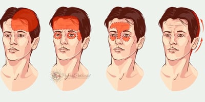 4 Types de Maux de Tête que l’on ne Devrait Jamais Ignorer