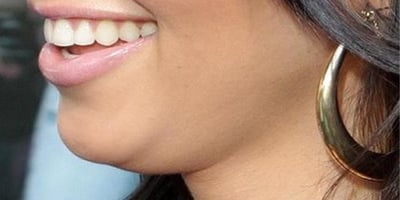 5 Exercices à Faire pour vous Débarrasser de ce Double Menton qui vous Gêne Tant! 5 Exercices à Faire pour vous Débarrasser de ce Double Menton qui vous Gêne Tant!