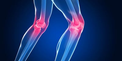 5 Exercices pour Soulager la Douleur au Genou en 6 Jours