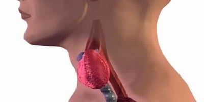 6 Aliments à Éviter si vous Souffrez d’un Trouble de la Thyroïde