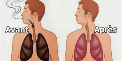 6 Aliments Extraordinaires qui Peuvent Purifier les Poumons D’un Fumeur ! 6 Aliments Extraordinaires qui Peuvent Purifier les Poumons D’un Fumeur !