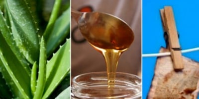 6 Aliments pour Apaiser les Démangeaisons dues aux Piqûres D’insectes