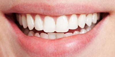 9 Conseils pour des Dents et des Gencives Saines et Belles