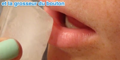 9 Remèdes pour Soigner un Bouton de Fièvre Rapidement et Naturellement