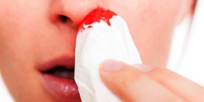 Astuces pour Arrêter le Saignement de Nez