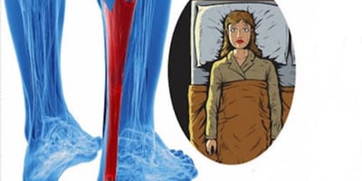 COMMENT PRÉVENIR LES CRAMPES AUX JAMBES, ET NE OBTENIR JAMAIS CES CRAMPES