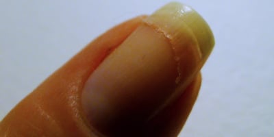 Réparer un Ongle Cassé avec un Sachet de Thé Réparer un Ongle Cassé avec un Sachet de Thé