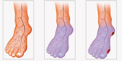 VOUS SOUFFREZ D'UNE MAUVAISE CIRCULATION? VOICI COMMENT RÉSOUDRE VOTRE PROBLÈME