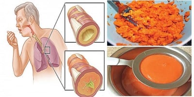Ancien Sirop fait Maison qui Élimine le Mucus des Poumons et Guérit la Toux ! Ancien Sirop fait Maison qui Élimine le Mucus des Poumons et Guérit la Toux !
