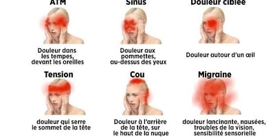 Apprenez à Reconnaître les Maux de Tête Dangereux Apprenez à Reconnaître les Maux de Tête Dangereux