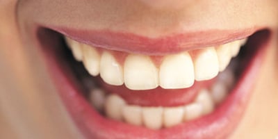 Avec un Ingrédient que Tout le Monde a à la Maison, Vos Dents Brilleront Plus que Jamais!
