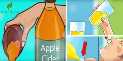 Boire du Vinaigre de Cidre de Pomme avant D'aller au Lit Changera Votre Vie