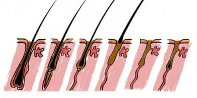 Ces 5 Aliments Accélèrent la Pousse de Cheveux Ces 5 Aliments Accélèrent la Pousse de Cheveux