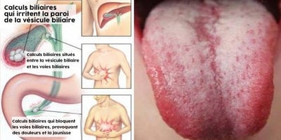 Ces 9 Signes Indiquent que vous Devez Éliminer les Toxines de votre Corps en Urgence ! Ces 9 Signes Indiquent que vous Devez Éliminer les Toxines de votre Corps en Urgence !