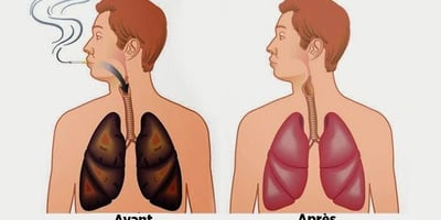 Ces Aliments Nettoient vos Poumons de la Nicotines et des Goudrons