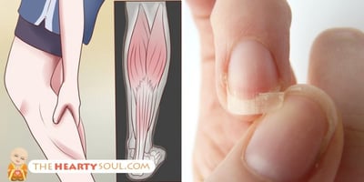 Cheveux ou Ongles Cassants ? Maux de Tête ou Crampes? Protubérances ou Acné? Vous Avez Probablement cette Carence