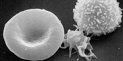 Comment Expliquer un Faible Taux de Globules Blancs