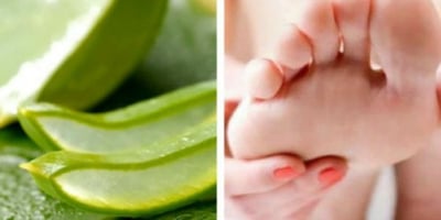 Comment Lutter Contre les Mycoses aux Pieds avec de L’aloe Vera ?