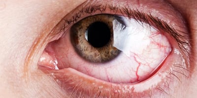 Comment protéger vos yeux devant un écran