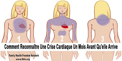 Reconnaître une Crise Cardiaque 1 Mois avant qu’elle Arrive !