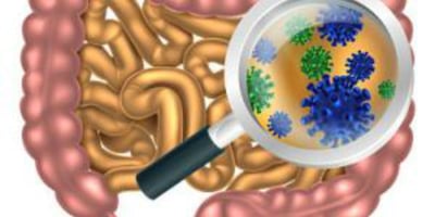 Comment Reconstituer sa Flore Intestinale