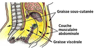 Comment se Débarrasser de la Graisse Abdominale, ce Tueur Silencieux