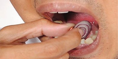 Comment Soulager les Maux de Dents et les Infections Dentaires Naturellement Comment Soulager les Maux de Dents et les Infections Dentaires Naturellement