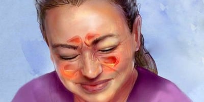 Comment Soulager votre Infection des Sinus en 20 Secondes ?