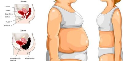 Dites Adieu à la Graisse Abdominale en 5 Étapes