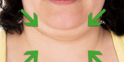 Eliminez votre Double Menton avec de L’argile et du Concombre