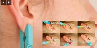 Elle se Pince L’oreille Tous les Jours avec une Pince à Linge, Découvrez Pourquoi…