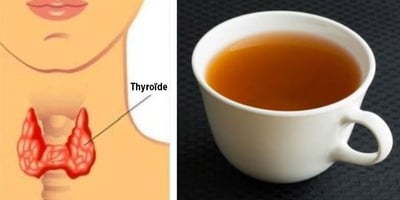 La Meilleure Façon de Perdre du Poids, si vous Avez un Trouble de la Thyroïde La Meilleure Façon de Perdre du Poids, si vous Avez un Trouble de la Thyroïde