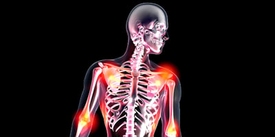 Le Mystère de la Fibromyalgie Le Mystère de la Fibromyalgie