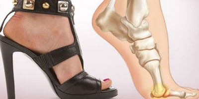 Les Dangers des Talons et Comment ils Affectent le Corps