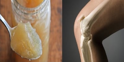 Les Médecins sont Étonnés par cette Recette qui Renforce les Os des Genoux et des Articulations Les Médecins sont Étonnés par cette Recette qui Renforce les Os des Genoux et des Articulations