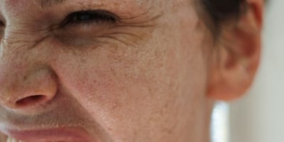 Masque Anti Rides : Recette de Grand-Mère