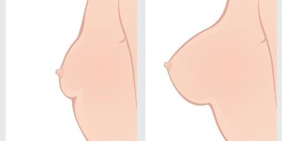 Pratiquez cette Astuce au Moins une Fois par Semaine pour Avoir des Seins Fermes !